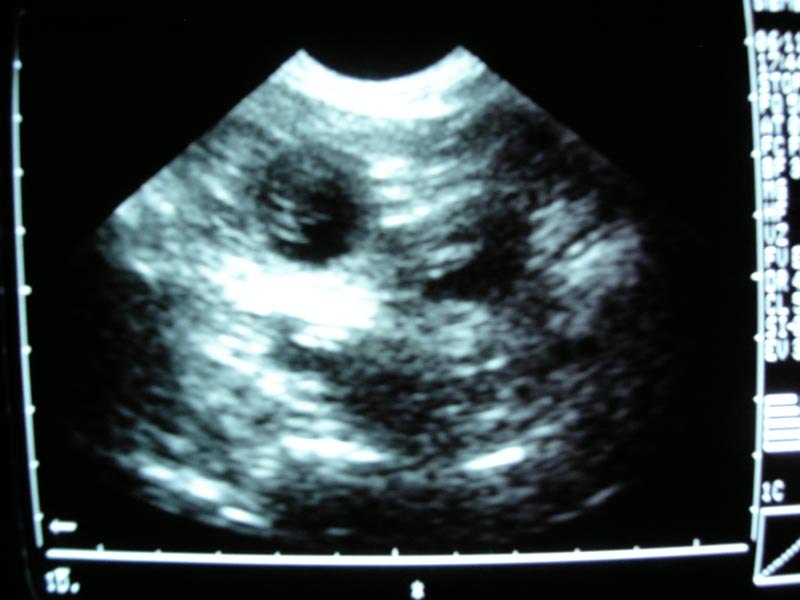 Ultrashallbild vom B-Wurf